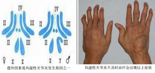 F(yng)(qing)ֱt(y)ԺL(fng)P(gun)(ji)z