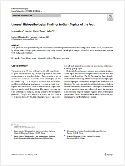 25ɫεȹͬ׫(xi)¡Unusual Histopathological Findings in Giant Tophus of the Foot㲿޴ʹL(fng)ʯĮMW(xu)F(xin)SCIڿIndian Journal of Surgeryl(f).png